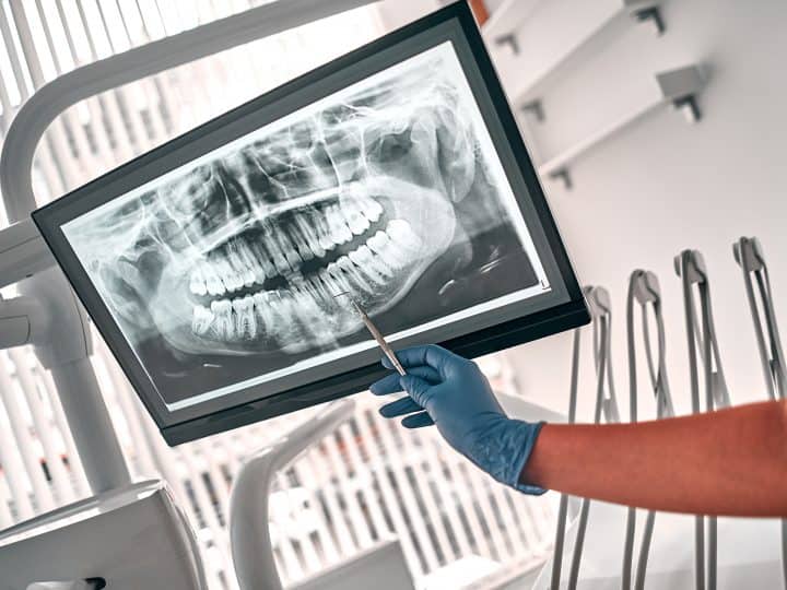 Here’s What You Need to Know About Dental X-rays While Pregnant