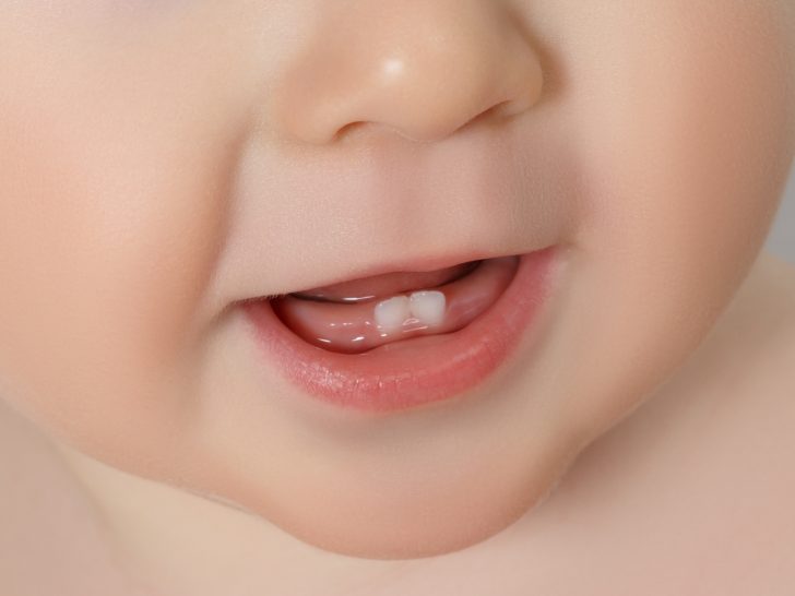 How to Pull Out a Baby Tooth Effectively?