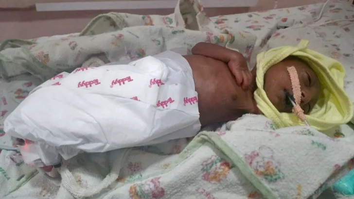 Baby Was Abandoned By Parents Due To Rare Skin Disease, But Her Grandfather Saved Her