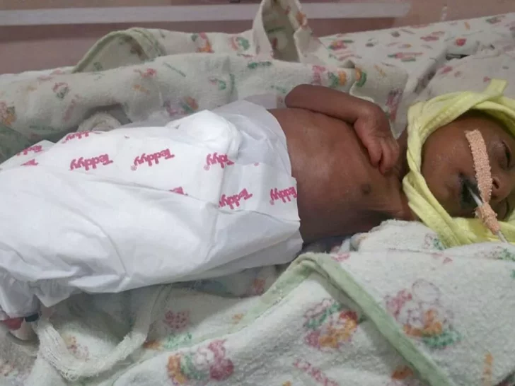 Baby Was Abandoned By Parents Due To Rare Skin Disease, But Her Grandfather Saved Her