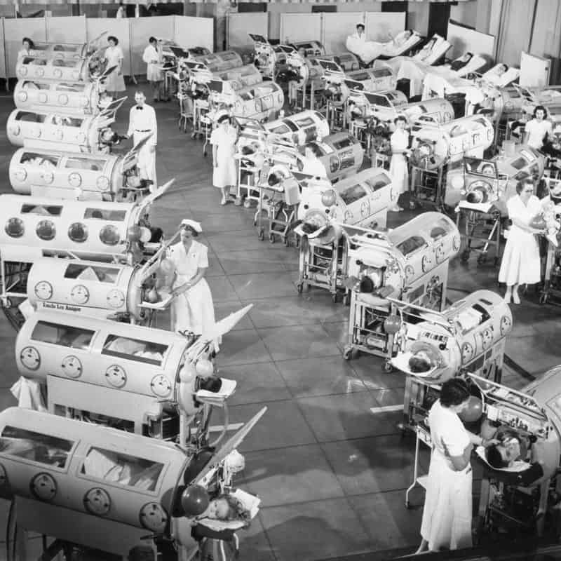 Polio and Other Epidemics