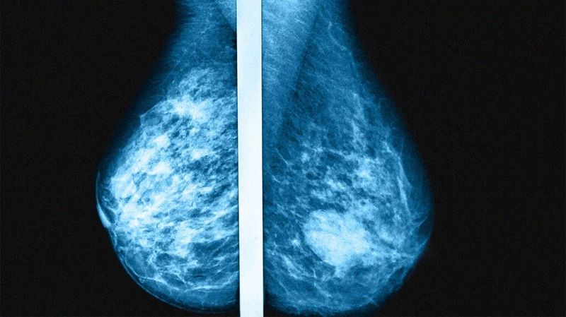 Changes in Breast Size or Shape