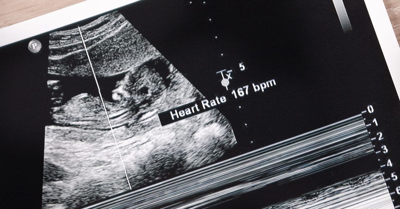 Heartbeat Rate