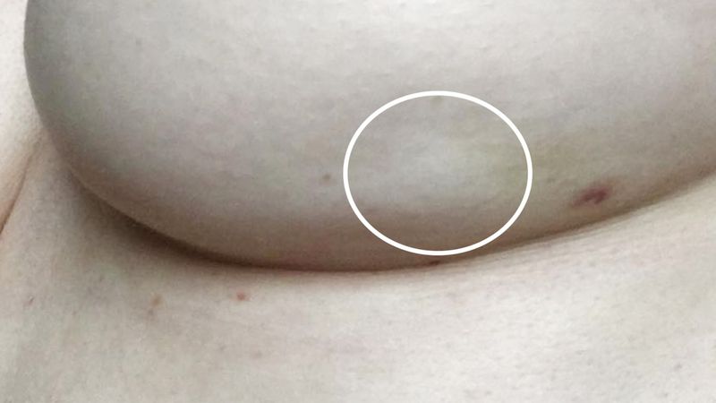 Visible Changes in the Breast