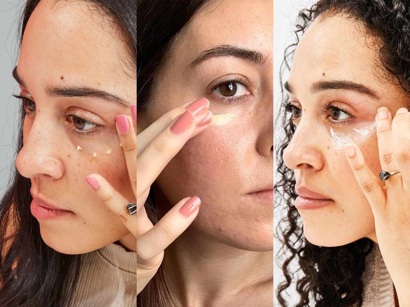 Fine Lines and Wrinkles