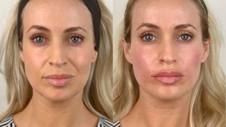 9 Facial Features That Make You Look Older Than Your Age (And How To Fix Them)