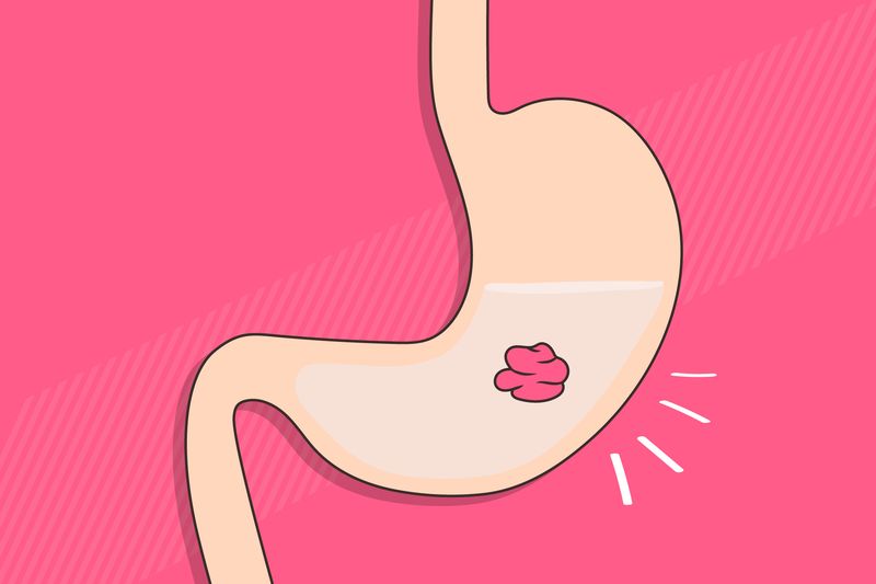 If you swallow gum, it stays in your stomach for seven years
