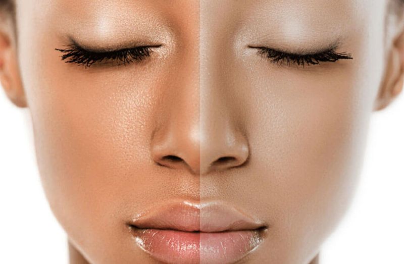 Dull Skin and Hair