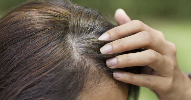 Hair Thinning and Graying