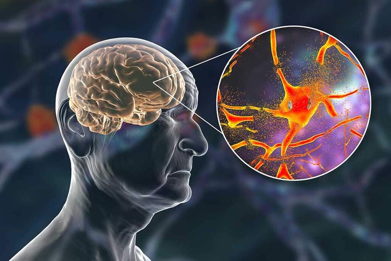 Poor Memory and Cognitive Decline
