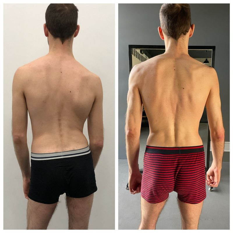 Posture and Gait