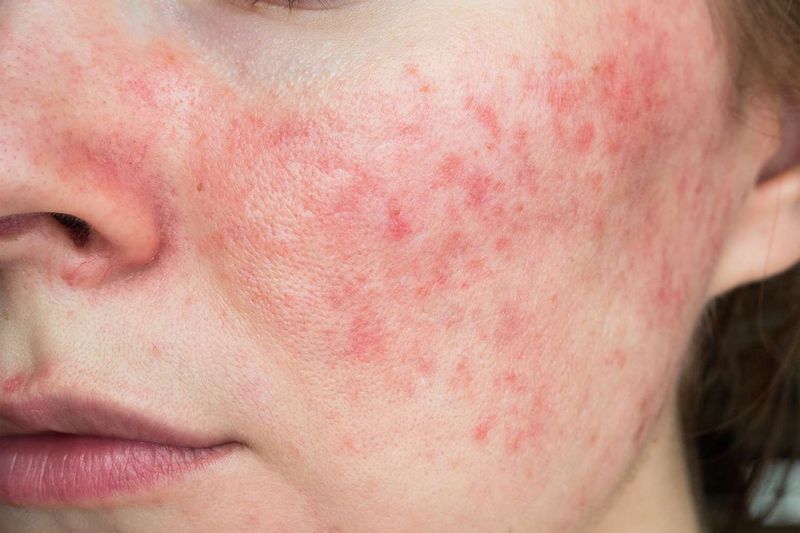 Skin Changes