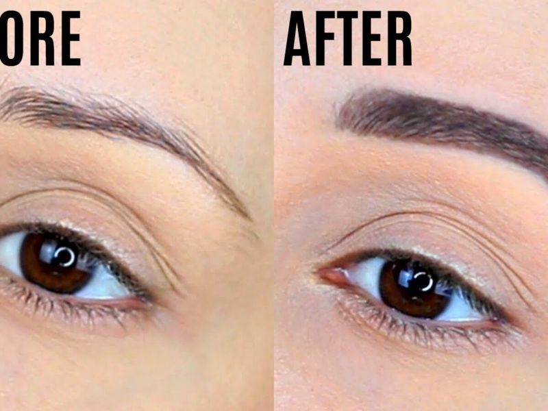 Thinning Eyebrows