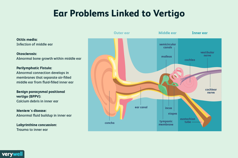 Inner Ear Infections