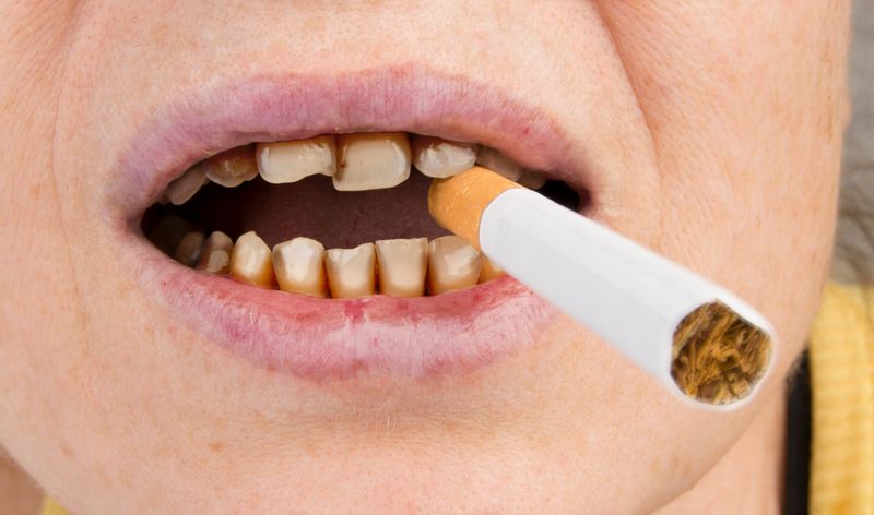 Tobacco Stains