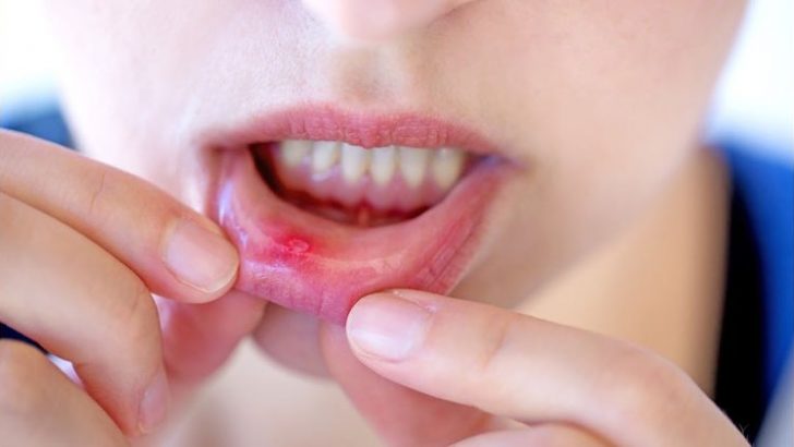 11 Things Your Dentist Sees That Instantly Tell Them Your Biggest Life Struggles