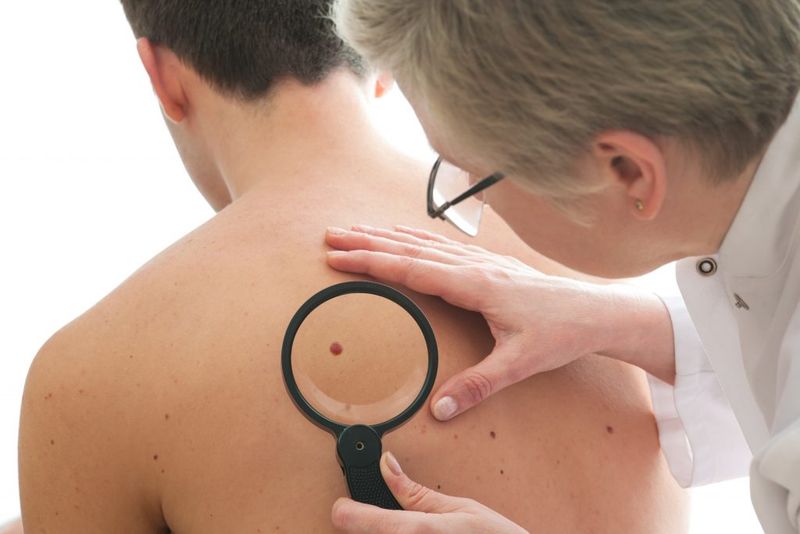 Skin Appearance