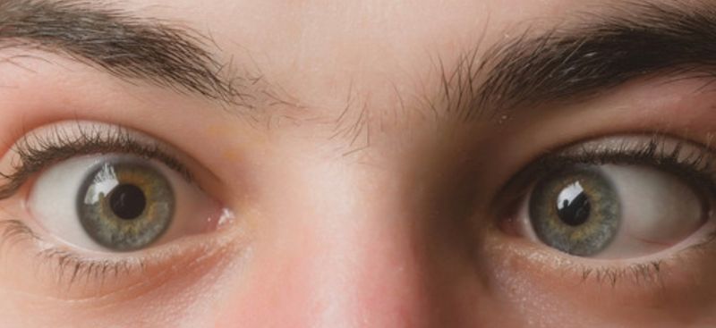 If You Cross Your Eyes, They'll Stay That Way